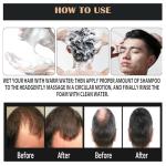 Root Activator Shampoo for Men-Hair Growth Shampoo for Hair Loss and Thinning Hair - Hair Loss for Women Men | Thickening & Nourishing For All Hair- 10.1 fl oz / 300 mL