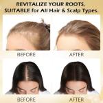 Root Activator Shampoo for Men-Hair Growth Shampoo for Hair Loss and Thinning Hair - Hair Loss for Women Men | Thickening & Nourishing For All Hair- 10.1 fl oz / 300 mL