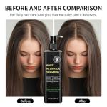 Root Activator Shampoo for Men-Hair Growth Shampoo for Hair Loss and Thinning Hair - Hair Loss for Women Men | Thickening & Nourishing For All Hair- 10.1 fl oz / 300 mL