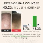 iRestore Essential Laser Hair Growth System + Rechargeable Battery Pack - FDA Cleared Hair Regrowth for Men & Women with Thinning Hair