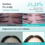 Hair Growth Shampoo for Hair Loss & Thinning | Clinically Proven DHT Blocker with Biotin, Caffeine & Panthenol | Hair Thickening Korean Shampoo | Hydrates Hair & Scalp | Sulfate-Free | 12.85 fl.oz.