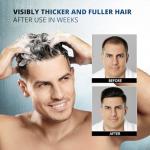 Root Activator Shampoo for Men - Hair Growth Shampoo for Hair Loss and Thinning Hair - Hair Loss RegrowthTreatments for Women Men (10.1 Fl Oz (Pack of 1))