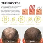 Instyle Egg 280 Cap for Hair Regrowth, Low Level Laser Therapy System for Hair Loss and Regrow Thinning Hair for Men/Women