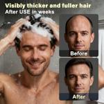 Root Activator Shampoo For Men - Hair Growth Shampoo for Hair Loss and Thinning Hair - 300 mL/10.1 fl oz