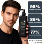 Root Activator Shampoo For Men - Hair Growth Shampoo for Hair Loss and Thinning Hair - 300 mL/10.1 fl oz