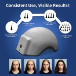 Laser Red Light Therapy for Hair Growth Device, FDA Cleared Hair Loss, Hair Growth Device