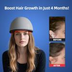 Laser Red Light Therapy for Hair Growth Device, FDA Cleared Hair Loss, Hair Growth Device