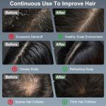 MERNUNUX Laser Therapy Hair Growth Comb, Electric Scalp Massager, Handheld Comb-Shaped Hair Regrowth Device for Hair Growth & Hair Care for Thicker, Healthier Hair