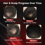 CAYAMA Red Light Therapy Cap for Hair – 510 LEDs Laser Hair Cap for Fuller, Healthier-Looking Hair, Light-Based Care Device for Men & Women