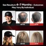 Laser Hair Growth Cap, Low Level Laser Therapy (LLLT) Device Designed to Promote Hair Growth in Women and Men,Laser Cap