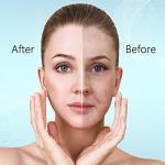 YourMate Handheld Phototherapy Device High Frequency Wand/Machine with Neon Tubes for Face Chin Neck Hair, Facial Skin Wand Machine with 4 Different Tube