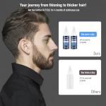 TecFlox 5% Minoxidil with Biotin for Men & Women, Beard Growth Oil, Hair Growth Serum, Unisex, 2-Pack, Total 4 fl oz for 4 Months