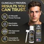 Elevate Hair Regrowth Treatment 5% Minoxidil Solution for Hair Growth - Extra Strength Topical Hair Growth Serum for Thicker, Fuller Hair 2 Fl Oz Made in USA