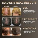 Laser Hair Growth Comb, Hair Growth Device, promote hair growth in women and men