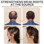 Root Activator Shampoo for Men and Women – Rosemary & Boiton Hair Growth Shampoo for Thinning Hair, Hair Loss & Scalp Health – Natural Herbal Formula with Cooling Sensation – Sulfate-Free – 10.1 fl oz