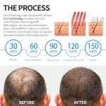 272 Laser Cap for Hair Growth, Hair Regrowth System for Men/Women, Scalp Treatment to Stop Hair Loss and Regrows Thinning Hair, Low Level Laser Therapy w/Medical Grade Lasers