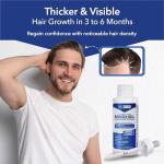 Hair-Regen Advanced 5% Minoxidil For Men Hair Regrowth Treatment for Thinning Hair - Hair Loss for Men - 6 Month Supply, Minoxidil Topical Solution So Thicker Fuller Hair Keeps Growing Amazing Results