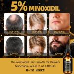 2-Pack 5% Minoxidil Hair Growth Serum for Men and Women, Hair Regrowth Treatment for Stronger, Thicker, and Longer Hair, Facial Hair Grooming and Thickening Solution