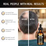 2-Pack 5% Minoxidil Hair Growth Serum for Men and Women, Hair Regrowth Treatment for Stronger, Thicker, and Longer Hair, Facial Hair Grooming and Thickening Solution