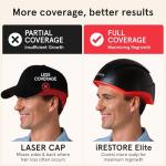 iRestore Elite + Rechargeable Battery Pack - Laser Red Light Therapy for Hair Growth - FDA Cleared Hair Loss, Hair Thinning Treatment for Men & Women - Hair Regrowth Laser Cap - 500 Lasers & LEDs