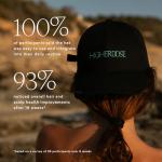 HigherDOSE Red Light Therapy Hat for Hair Growth - Reduce Hair Loss & Shedding - Targeted Infrared Red Light Therapy to Support Scalp Health