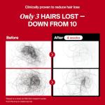 Dr.forhair Folligen Hair Loss Prevention Shampoo, 16.9 Fluid Ounce