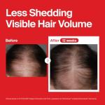 Dr.forhair Folligen Hair Loss Prevention Shampoo, 16.9 Fluid Ounce