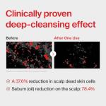 Dr.forhair Folligen Hair Loss Prevention Shampoo, 16.9 Fluid Ounce