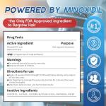 Minoxidil for Men Hair Growth Spray - 5% Topical Hair Regrowth Treatment for Thinning Hair and Beard Growth, Extra Strength Hair Loss Solution, 1-Month Supply, 2 Fl Oz (Pack of 1)