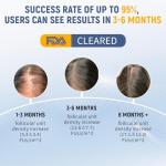 Laser Comb for Hair Growth, Red Light Therapy for Hair Growth, Laser Hair Growth Device Medical Grade Lasers, Stimulates Hair Growth, Reverses Thinning