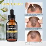 2-Pack 5% Minoxidil Hair Growth Serum, Hair Regrowth Treatment for Men and Women, Strengthens and Thickens Hair for Fuller, Longer Results, Beard and Facial Hair Enhancer