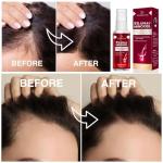 Hair Growth Shampoo for Thinning Hair: Advanced Biotin and Rosemary Shampoo with Rice Water for Women and Men Hair Loss - Herbal Essences Promotes Hair Root Activator, 10.5 Fl Oz
