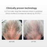 Xtrallux Turbo Pro Laser Hair Growth Cap with 316 Lasers – 6 Minute Treatment Time for Thinning Hair | Hair Loss Treatment | Hair Regrowth Cap for Men and Women