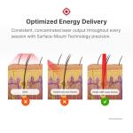 Xtrallux Turbo Pro Laser Hair Growth Cap with 316 Lasers – 6 Minute Treatment Time for Thinning Hair | Hair Loss Treatment | Hair Regrowth Cap for Men and Women