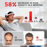 OVEKPA Red Light Therapy for Hair Growth Laser Cap - FDA Cleared Laser Therapy Device - Promotes Hair Regrowth Alopecia Treatment for Men & Women