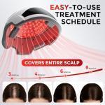 OVEKPA Red Light Therapy for Hair Growth Laser Cap - FDA Cleared Laser Therapy Device - Promotes Hair Regrowth Alopecia Treatment for Men & Women