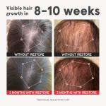 iRestore Advanced Hair Growth Supplement for Women with Lustriva, Hair Vitamins for Faster Hair Regrowth, Best for Hair Loss and Thinning, 1 Month Supply - 1 Count (Pack of 1) - Black