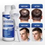 Hair Regen Liquid Minoxidil Men 5% Percent - Extra Strength Advanced Topical Solution for Regrowth Serum Drops - Clinically Proven Growth Treatment for Hims Hair Loss 1 Pack as 1 Month Supply Kit