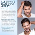 5% Minoxidil for Men and Women Hair Growth, Minoxidil Spray For Beard Growth Serum, Combat Hair Thinning and Loss, Strengthen Regrowth Treatment 3.38 Fl Oz