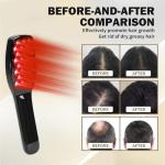 Electric Hair Growth Comb - Hair Care Comb for Dandruff Removal - Built-in Anion Device -Rechargeable - Scalp Massager Follicle Stimulation Tool