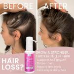 2% Minoxidil for Women Hair Regrowth Spray– Minoxidil Thicker & Fuller Topical Solution for Hair Loss Treatment, Follicle Reactivation - 60 ml (Pack of 2)