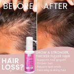 2% Minoxidil for Women Hair Regrowth Spray– Minoxidil Thicker & Fuller Topical Solution for Hair Loss Treatment, Follicle Reactivation - 60 ml (Pack of 2)