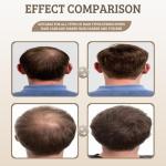 Root Activator Hair Loss Thickening Shampoo for Hair Regrowth, Unisex, Natural Formula for Men and Women（1 PCS）