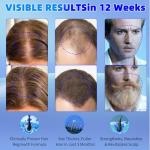 Men's 5% Minoxidil Serum for Hair Regrowth, Topical Hair Loss Treatment for Men to Regrow Fuller, Thicker Hair, Unscented Minoxidil Topical Aerosol