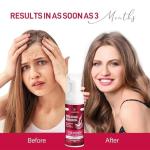 Yzmoffer 5% Minoxidil Foam for Women, Hair Regrowth Treatment for Thinning Hair and Hair Loss, Lightweight Non-Greasy Formula, Dermatologist Recommended, 2 × 60g (2-Month Supply)