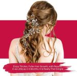 Yzmoffer 5% Minoxidil Foam for Women, Hair Regrowth Treatment for Thinning Hair and Hair Loss, Lightweight Non-Greasy Formula, Dermatologist Recommended, 2 × 60g (2-Month Supply)