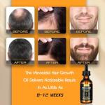 5% Minoxidil Hair Growth Oil for Men & Women - Extra Strength Regrowth Serum, Topical Hair Loss Treatment Serum, Thicker, Healthier Hair & Beard Growth Kit, 2.11 fl.oz