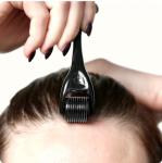 ROSELYNBOUTIQUE Derma Roller for Hair Beard Facial Skin Face 540 Titanium Microneedle - At-Home Beauty Instrument - Holiday Gift for Men Women