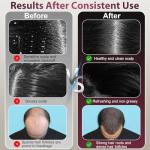 Laser Therapy Hair Growth Comb, Hair Oil Applicator,Electric Scalp Massager Hair Growth with IPX7 Waterproof