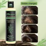 Organic Rosemary Hair Growth Shampoo for Thinning Hair & Hair Loss - Thickening & Strengthening Formula with Hydrolyzed Keratin for Men & Women (3-Pcs)